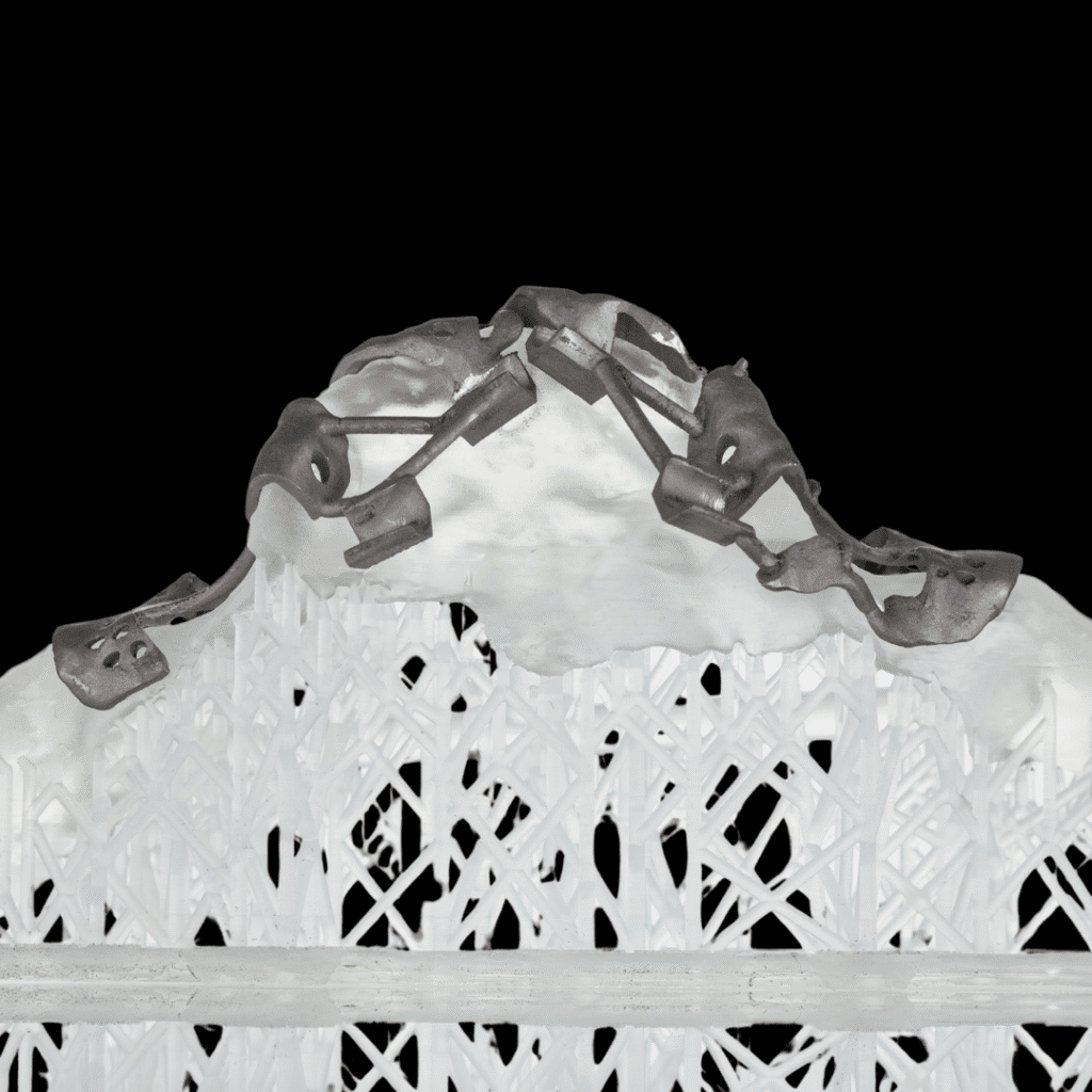 Subperiosteal implants