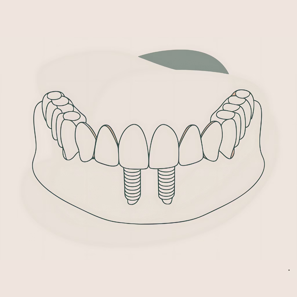 Implants Trans-Sinusiens en Turquie