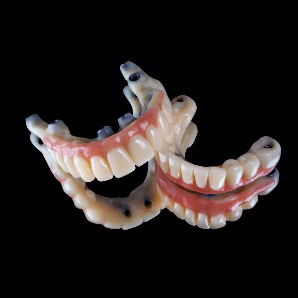 Warranty on Dental Implants